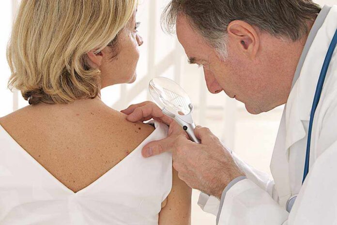 Doctor examining a patients skin with a magnifying glass